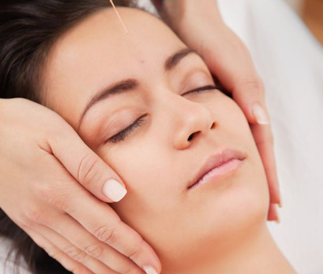 Photo of a woman's face with an acupuncture needle on her forehead