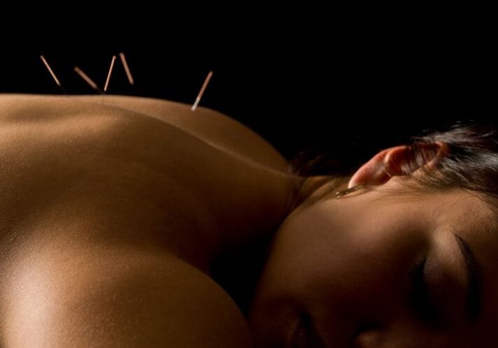Acupuncture photo black background