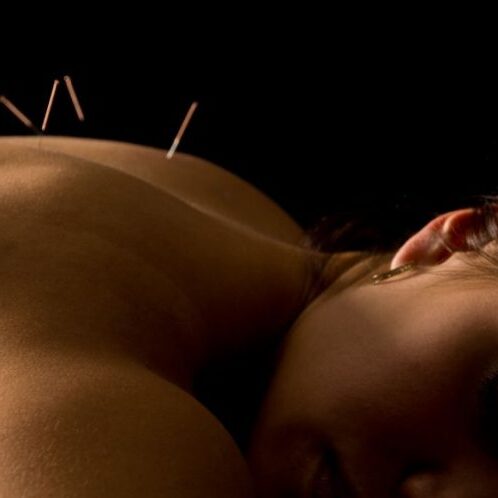 Acupuncture photo black background